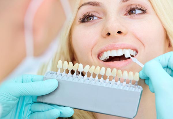 Whitening 1 - Cosmetic Dentistry