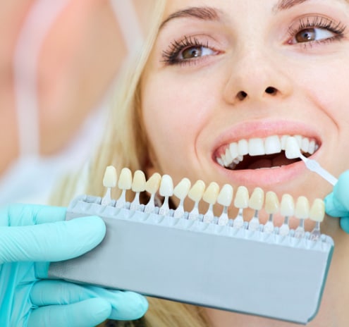 veneers - Veneers & Crowns